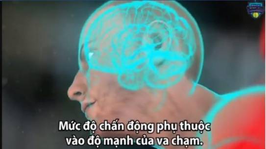 Sự Nguy Hiểm Của Chấn Thương Não Trong Thể Thao